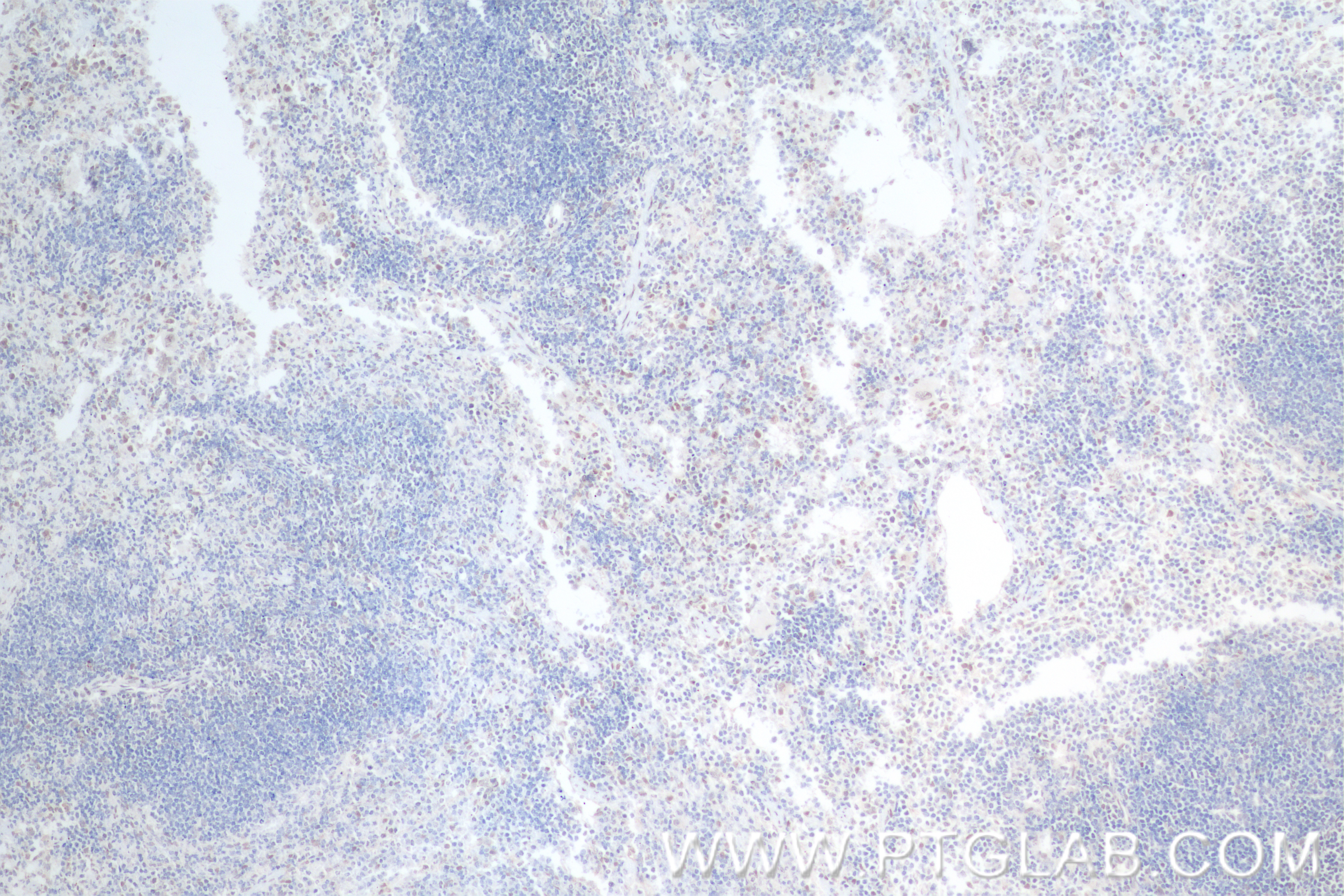 Immunohistochemistry (IHC) staining of mouse spleen tissue using BCL3 Recombinant antibody (84882-5-RR)