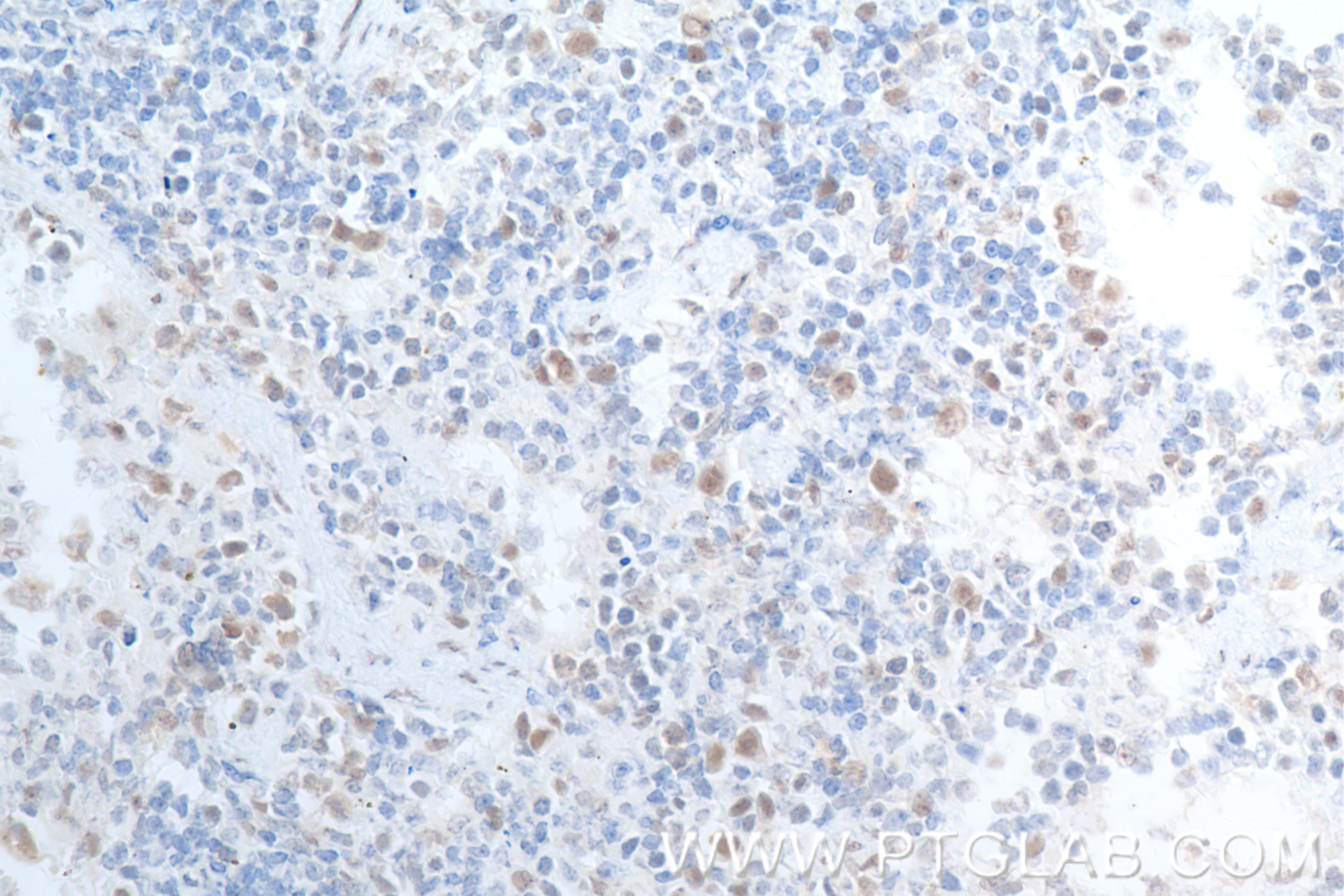 Immunohistochemistry (IHC) staining of mouse spleen tissue using BCL3 Recombinant antibody (84882-5-RR)