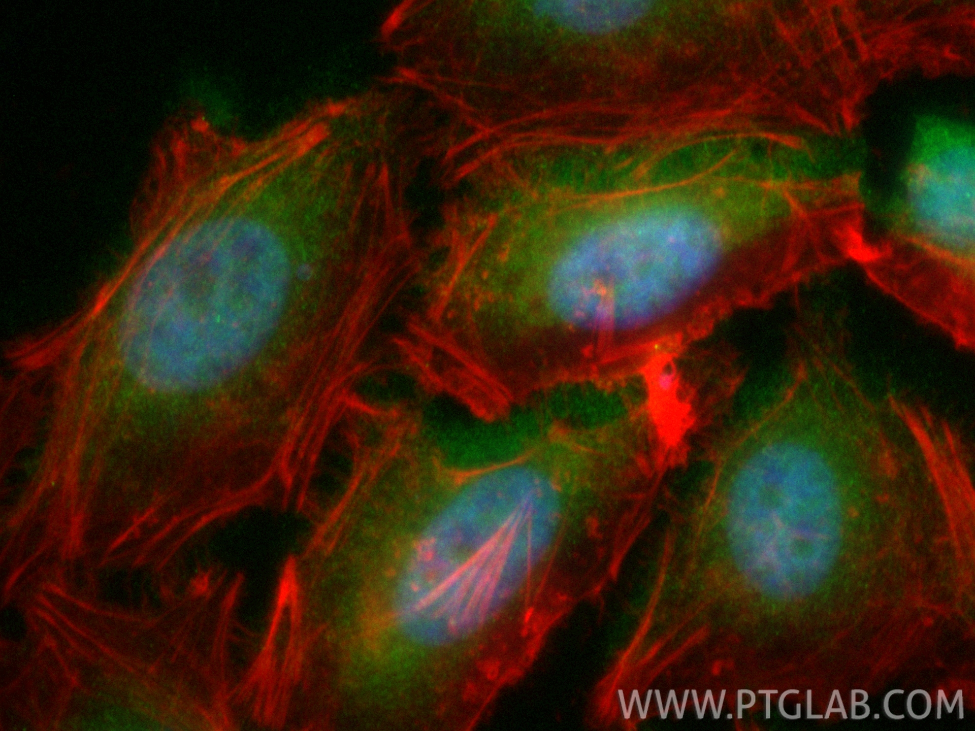 Immunofluorescence (IF) / fluorescent staining of HeLa cells using CoraLite® Plus 488-conjugated BCL3 Recombinant ant (CL488-84882-5)