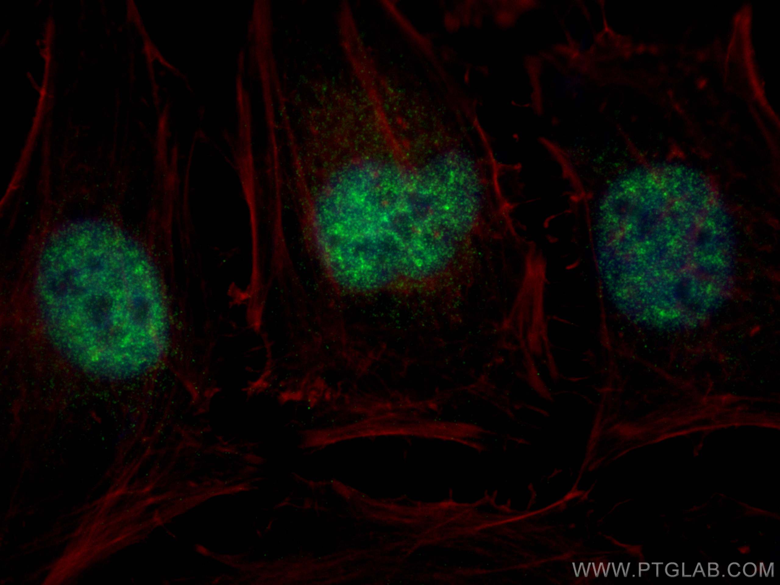 Immunofluorescence (IF) / fluorescent staining of HeLa cells using BCL9 Polyclonal antibody (22947-1-AP)