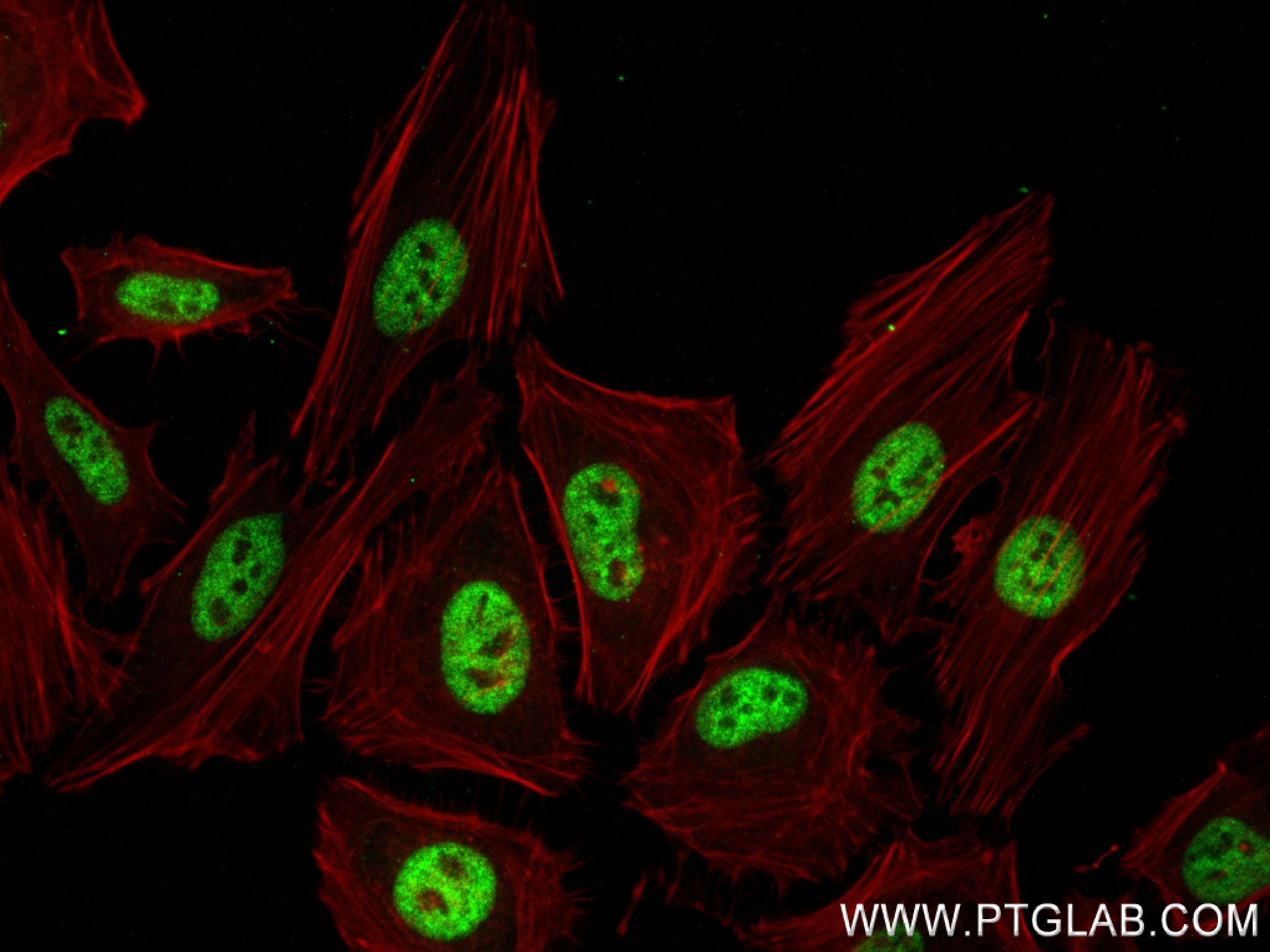 Immunofluorescence (IF) / fluorescent staining of HeLa cells using BCL9 Recombinant antibody (83760-3-RR)