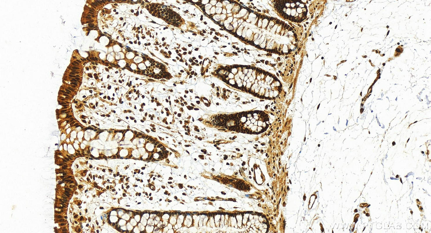 Immunohistochemistry (IHC) staining of human colon tissue using BCLAF1 Polyclonal antibody (26809-1-AP)