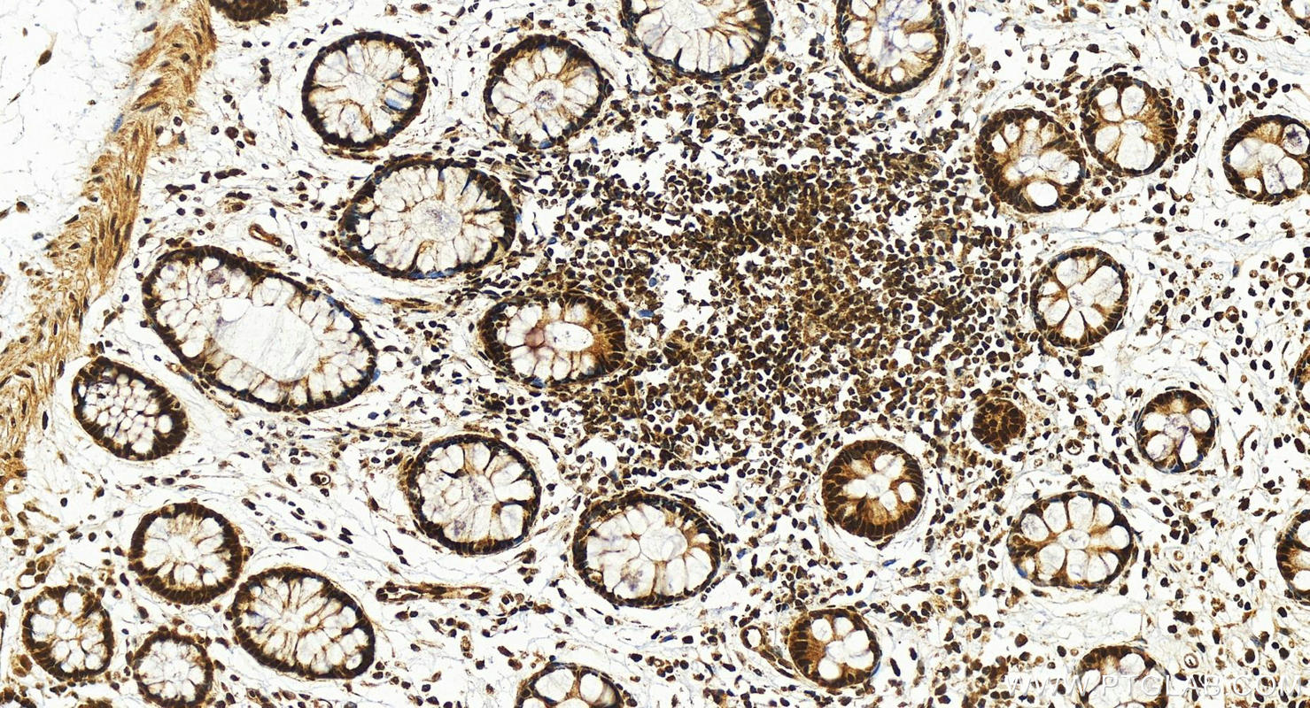 Immunohistochemistry (IHC) staining of human colon tissue using BCLAF1 Polyclonal antibody (26809-1-AP)