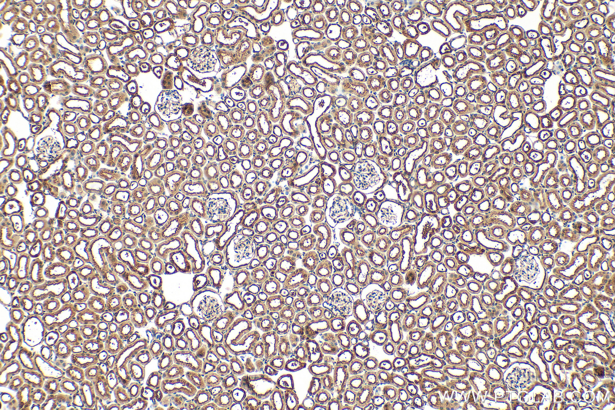 Immunohistochemistry (IHC) staining of mouse kidney tissue using BCLAF1 Polyclonal antibody (26809-1-AP)