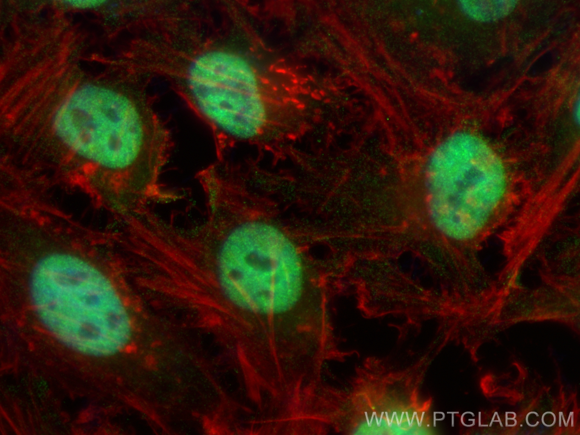 Immunofluorescence (IF) / fluorescent staining of HeLa cells using BCLAF1 Monoclonal antibody (67860-1-Ig)