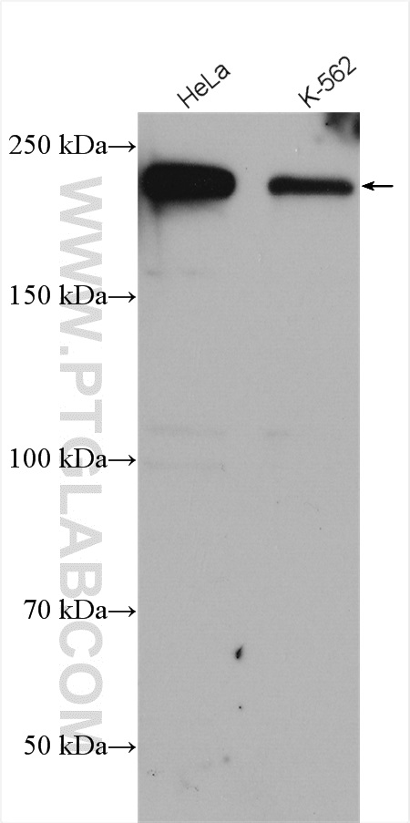 BCOR antibody (12107-1-AP) | Proteintech