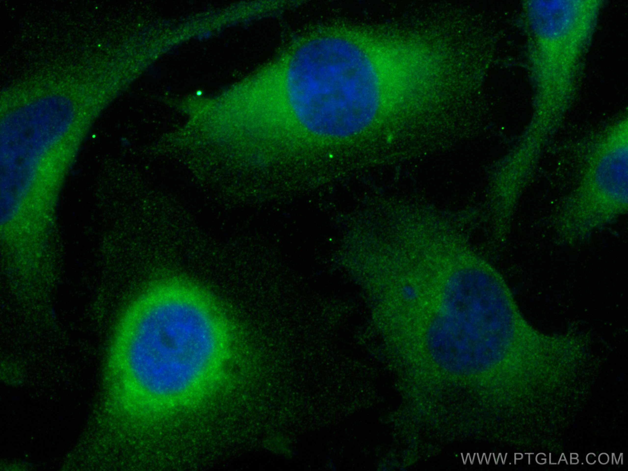 Immunofluorescence (IF) / fluorescent staining of HeLa cells using BCR Polyclonal antibody (22585-1-AP)