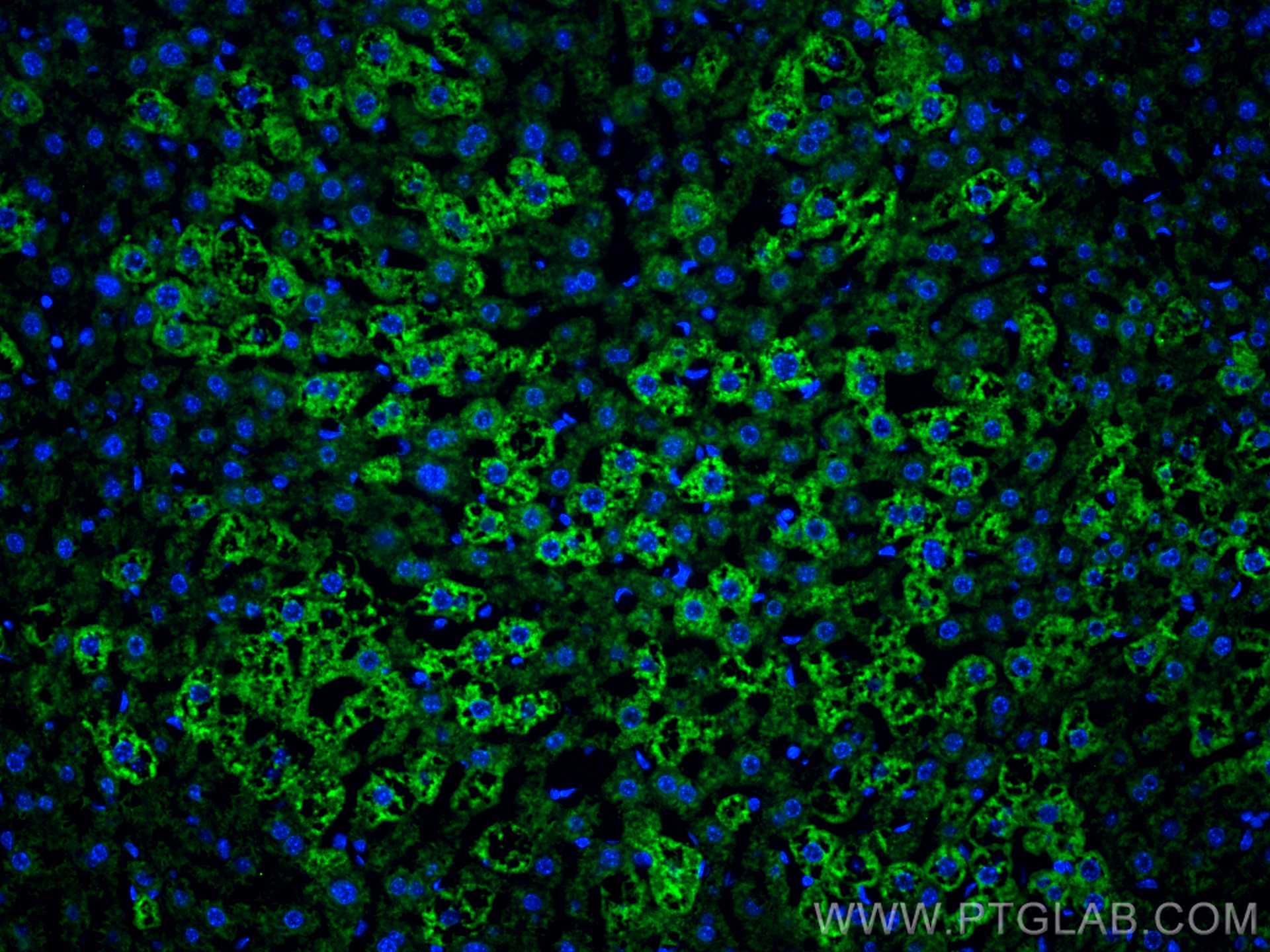 Immunofluorescence (IF) / fluorescent staining of mouse liver tissue using BDH1 Polyclonal antibody (15417-1-AP)