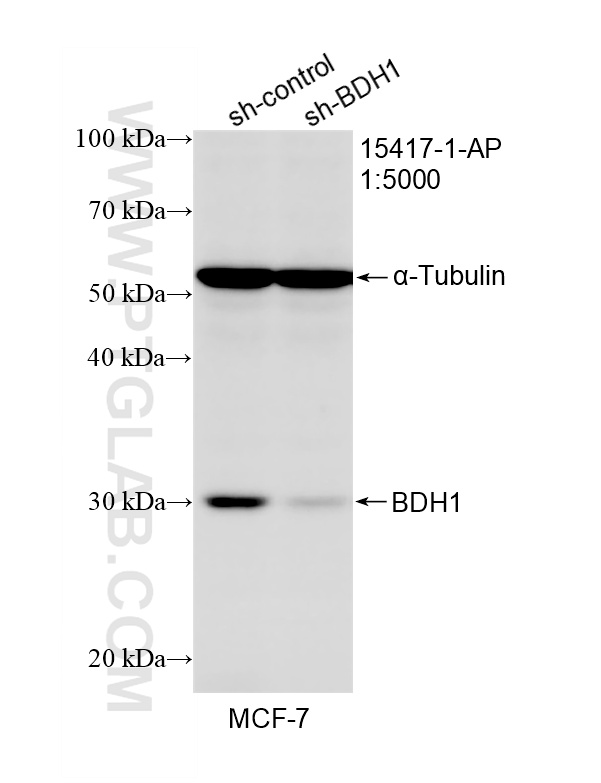 Western Blot (WB) analysis of MCF-7 cells using BDH1 Polyclonal antibody (15417-1-AP)