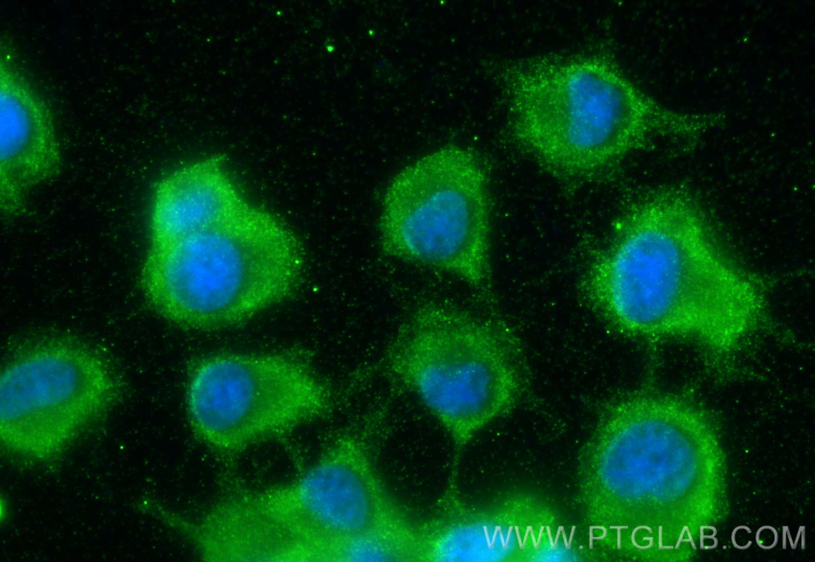 Immunofluorescence (IF) / fluorescent staining of PC-12 cells using BDNF Polyclonal antibody (25699-1-AP)