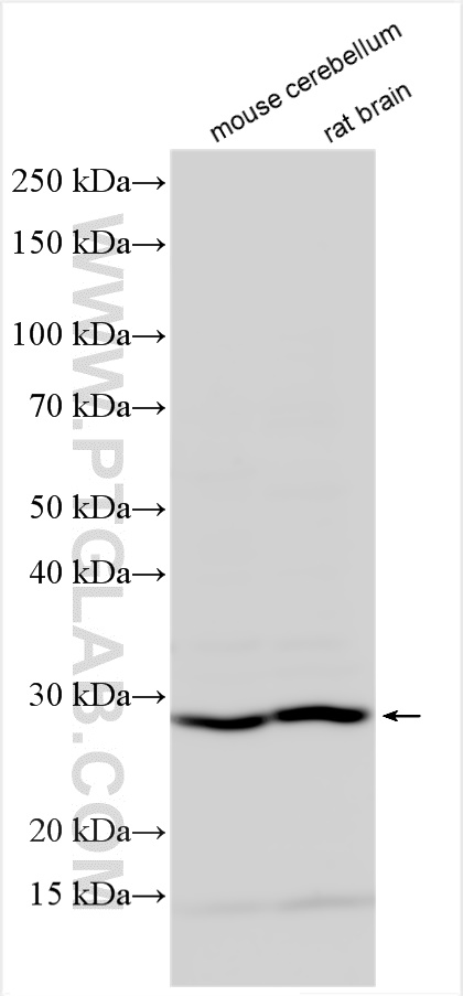 Western Blot (WB) analysis of various lysates using BDNF Polyclonal antibody (28205-1-AP)