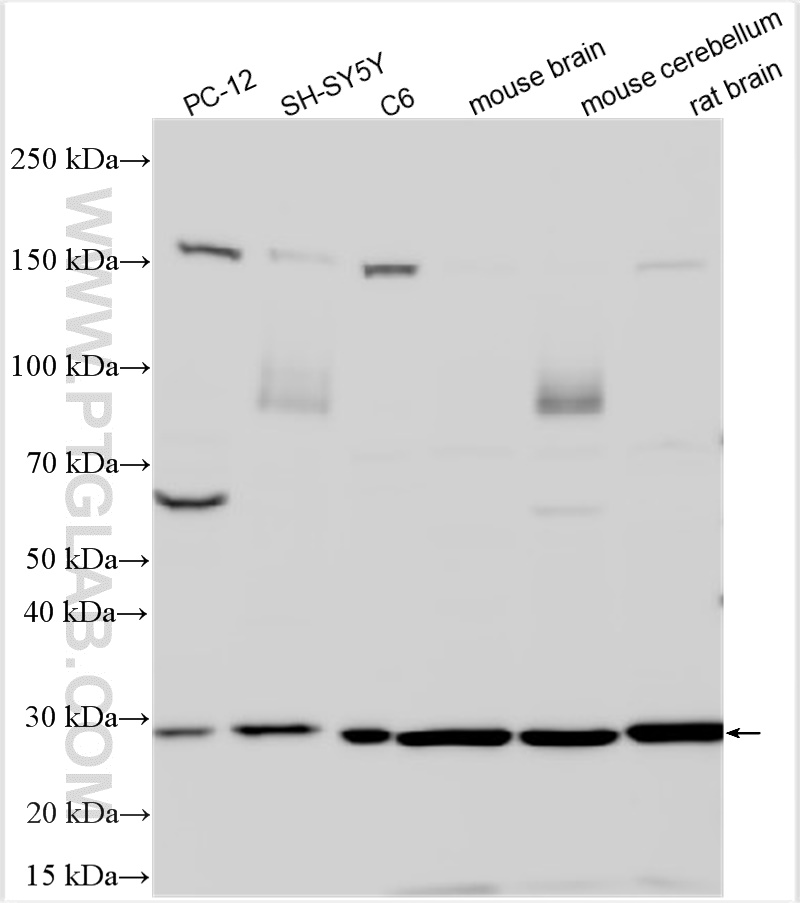 Western Blot (WB) analysis of various lysates using BDNF Polyclonal antibody (28205-1-AP)