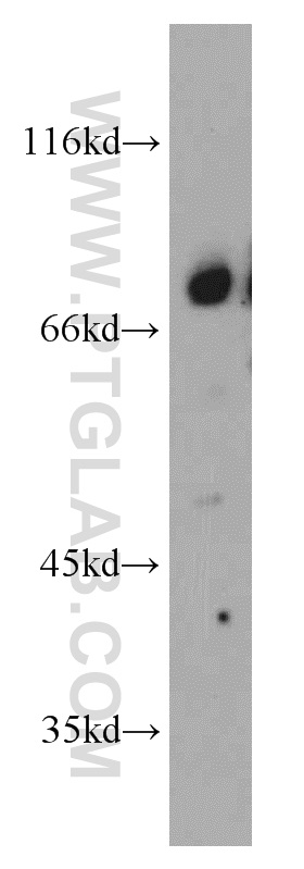 Beta ENaC Polyclonal antibody