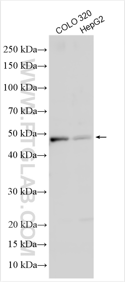 Western Blot (WB) analysis of various lysates using Biglycan Polyclonal antibody (16409-1-AP)