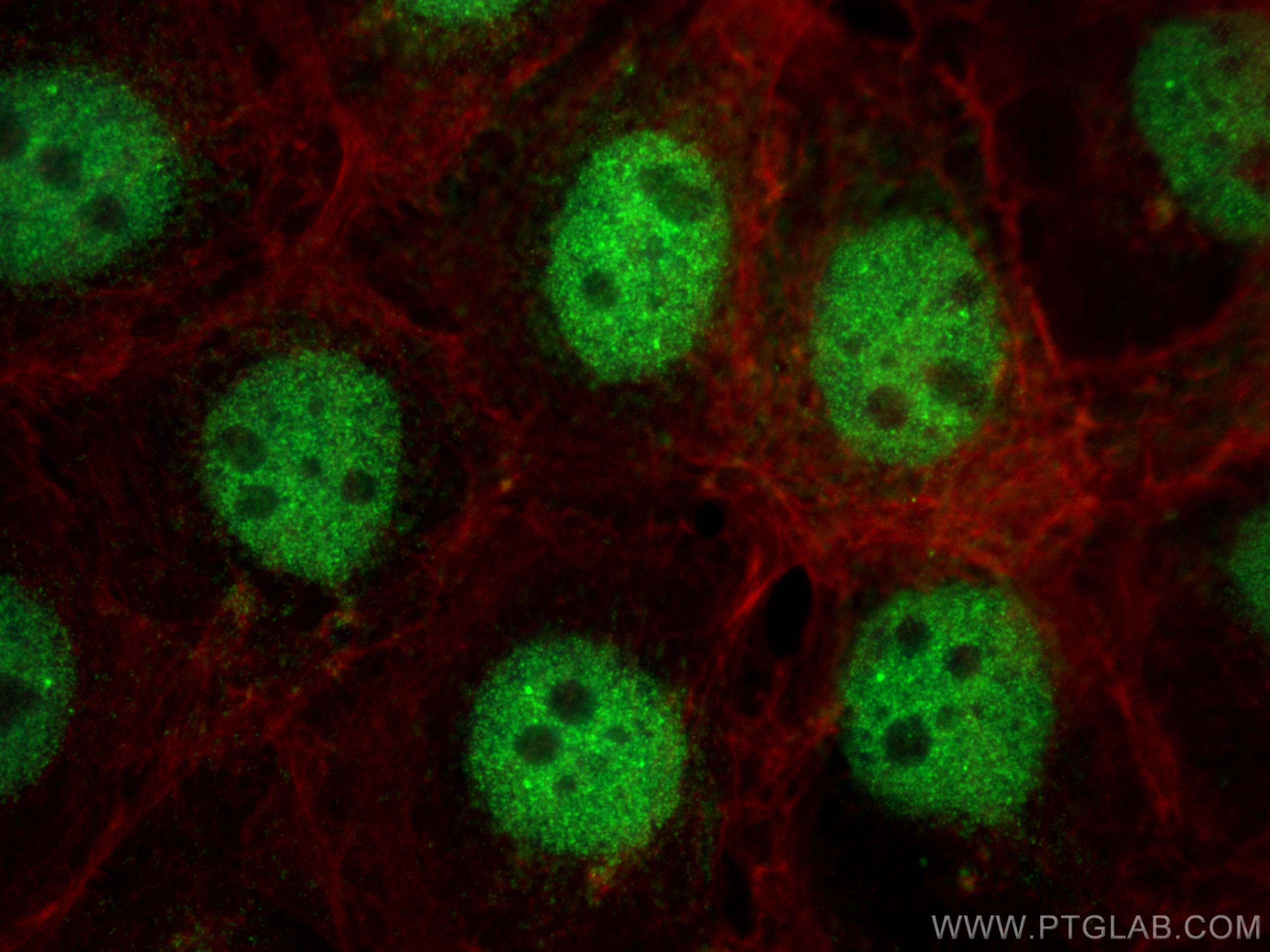 Immunofluorescence (IF) / fluorescent staining of A431 cells using BHLHE41 Polyclonal antibody (12688-1-AP)