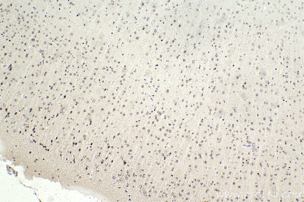 Immunohistochemistry (IHC) staining of mouse brain tissue using BHLHE41 Polyclonal antibody (12688-1-AP)