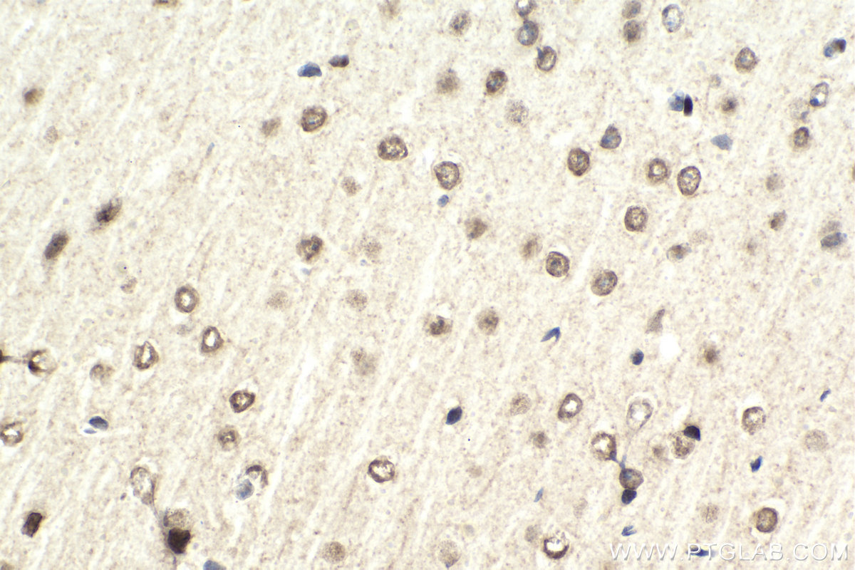 Immunohistochemistry (IHC) staining of mouse brain tissue using BHLHE41 Polyclonal antibody (12688-1-AP)