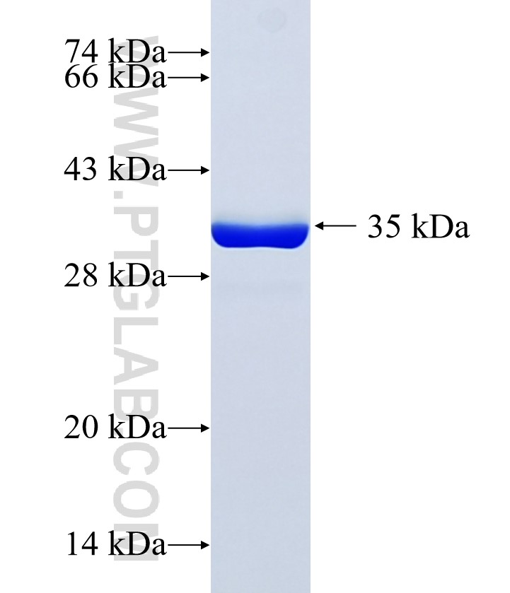 BLOC1S2 fusion protein Ag2807 SDS-PAGE