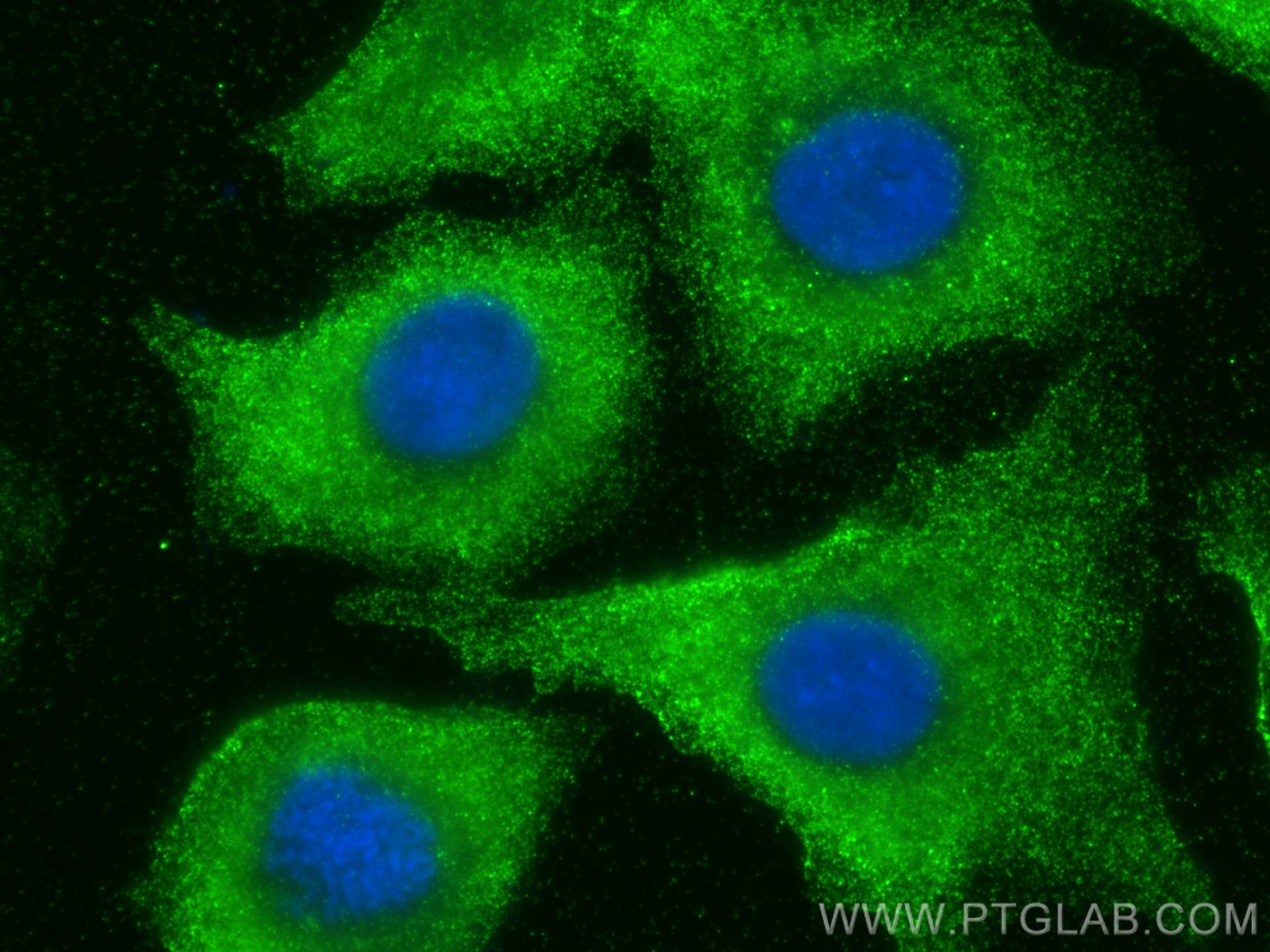 Immunofluorescence (IF) / fluorescent staining of A549 cells using BLVRA Monoclonal antibody (68175-1-Ig)