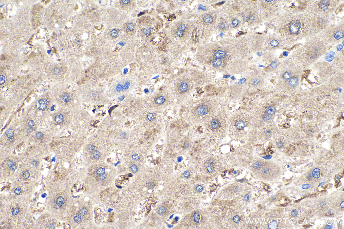 Immunohistochemistry (IHC) staining of human liver tissue using BLVRB Polyclonal antibody (17727-1-AP)