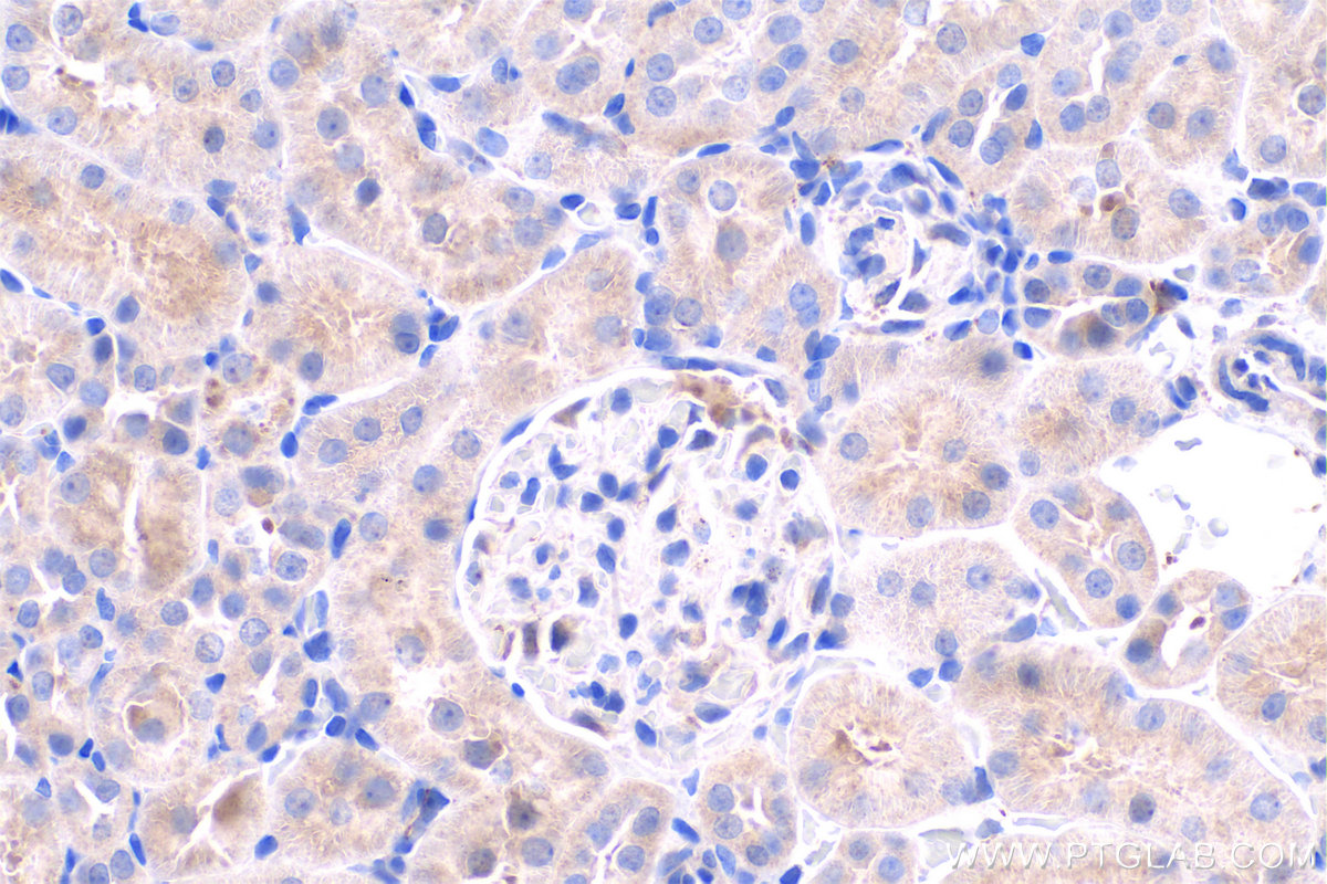 Immunohistochemistry (IHC) staining of rat kidney tissue using BLVRB Polyclonal antibody (17727-1-AP)