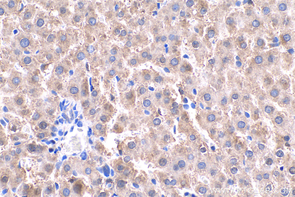 Immunohistochemistry (IHC) staining of rat liver tissue using BLVRB Polyclonal antibody (17727-1-AP)