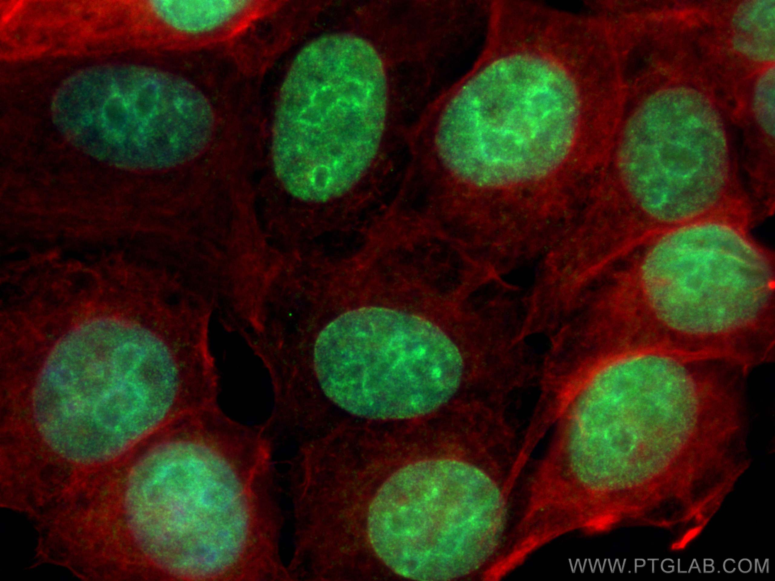 Immunofluorescence (IF) / fluorescent staining of MCF-7 cells using BMI1 Polyclonal antibody (10832-1-AP)