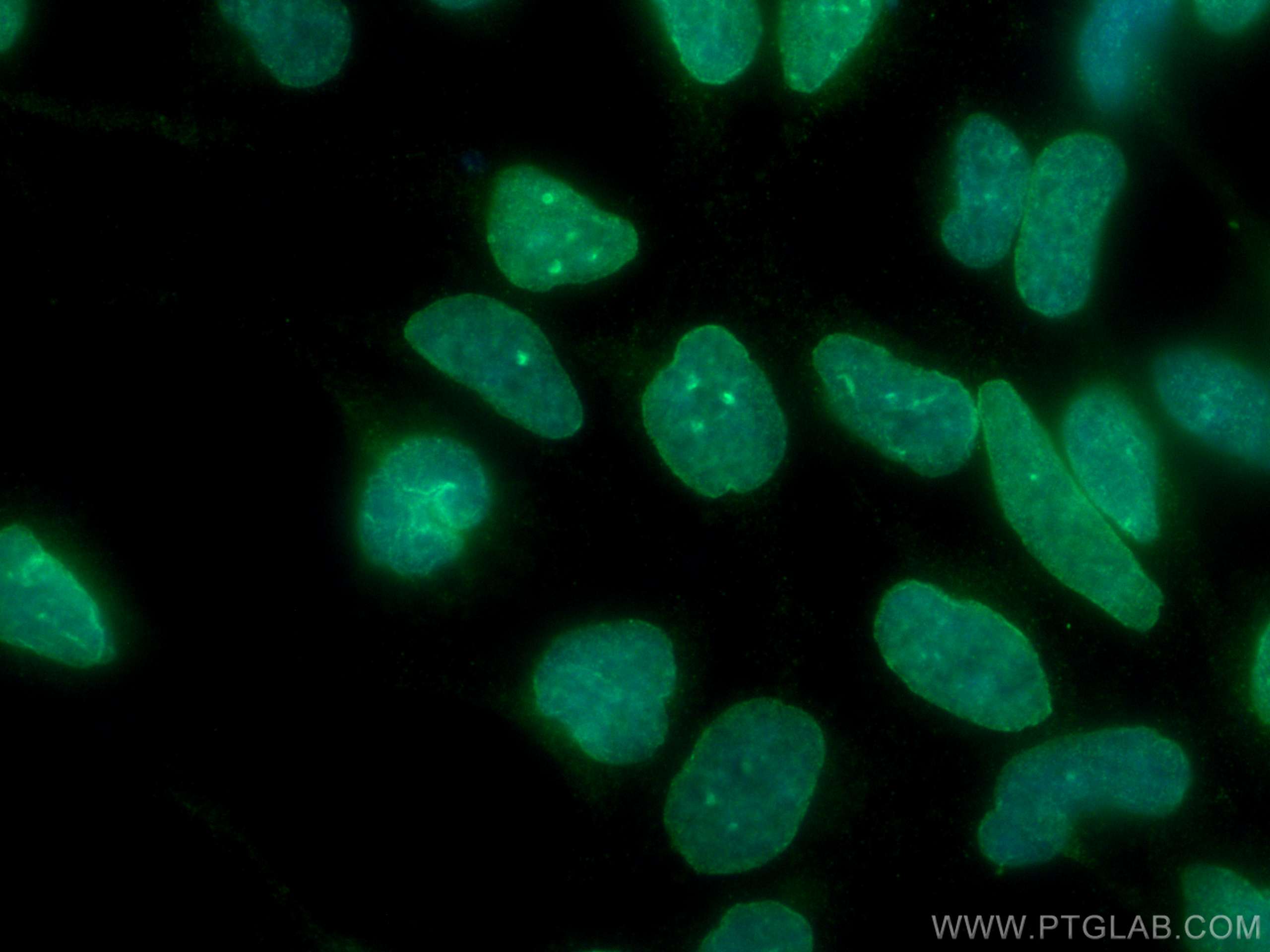 Immunofluorescence (IF) / fluorescent staining of HEK-293 cells using BMI1 Monoclonal antibody (66161-1-Ig)