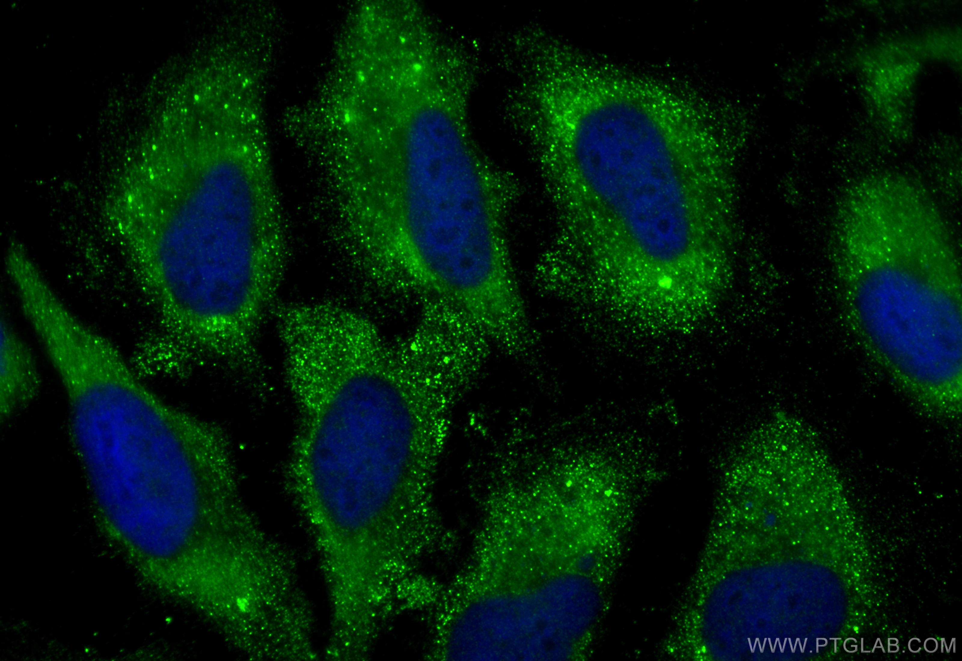 Immunofluorescence (IF) / fluorescent staining of HeLa cells using BMPR1A Polyclonal antibody (12702-1-AP)