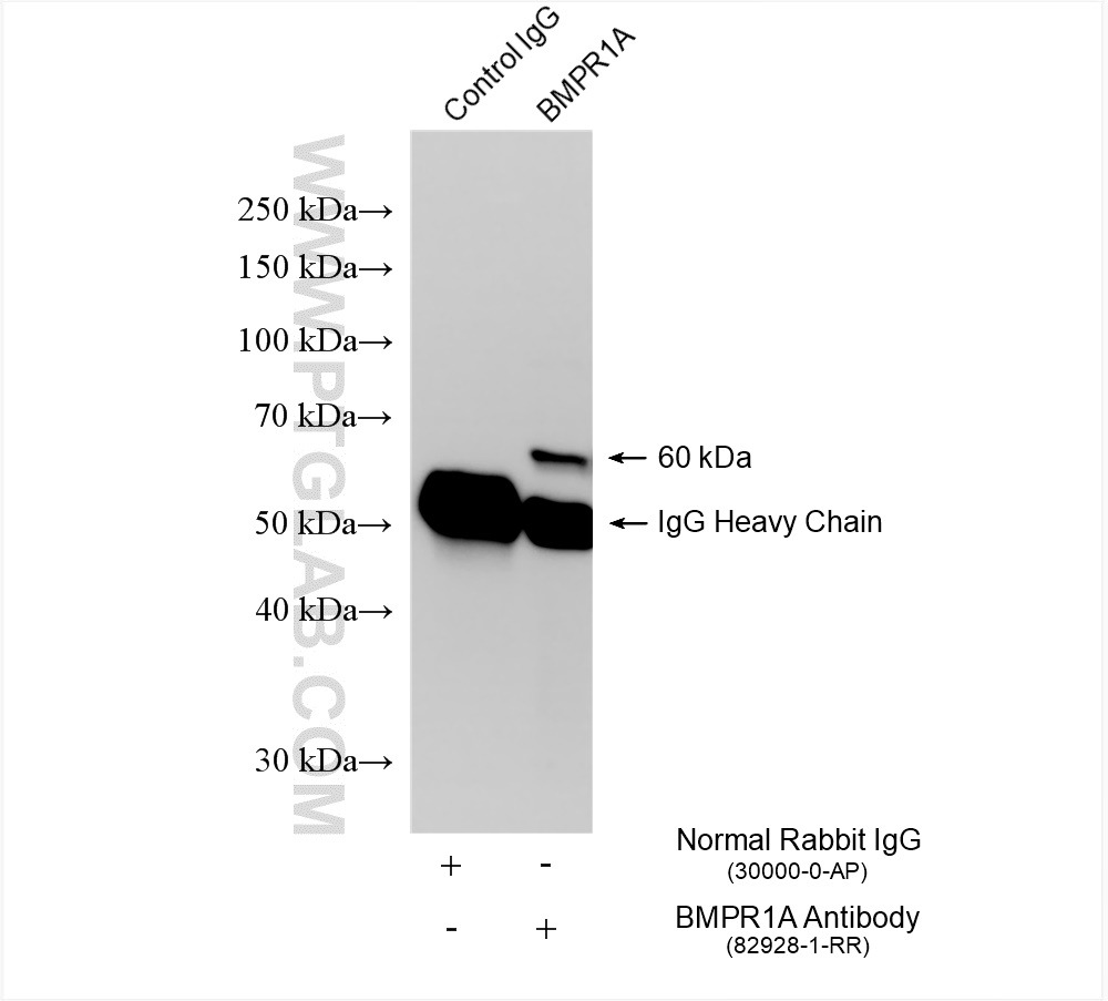 Immunoprecipitation (IP) experiment of HEK-293 cells using BMPR1A Recombinant antibody (82928-1-RR)