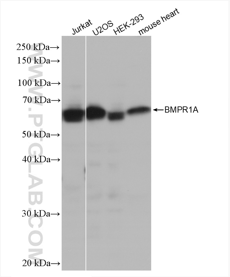 Western Blot (WB) analysis of various lysates using BMPR1A Recombinant antibody (82928-1-RR)