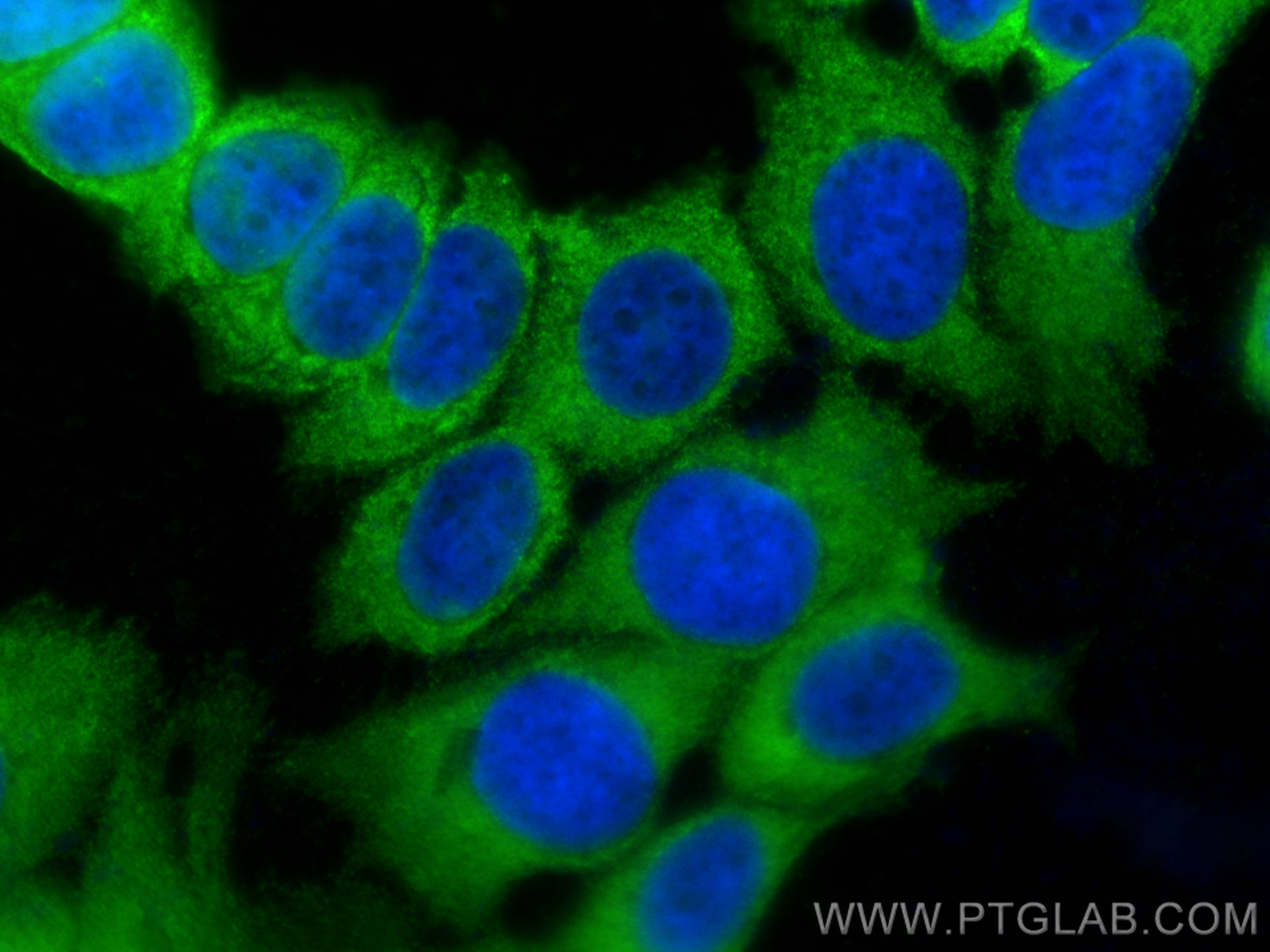 Immunofluorescence (IF) / fluorescent staining of MCF-7 cells using BMPR1B Polyclonal antibody (26696-1-AP)