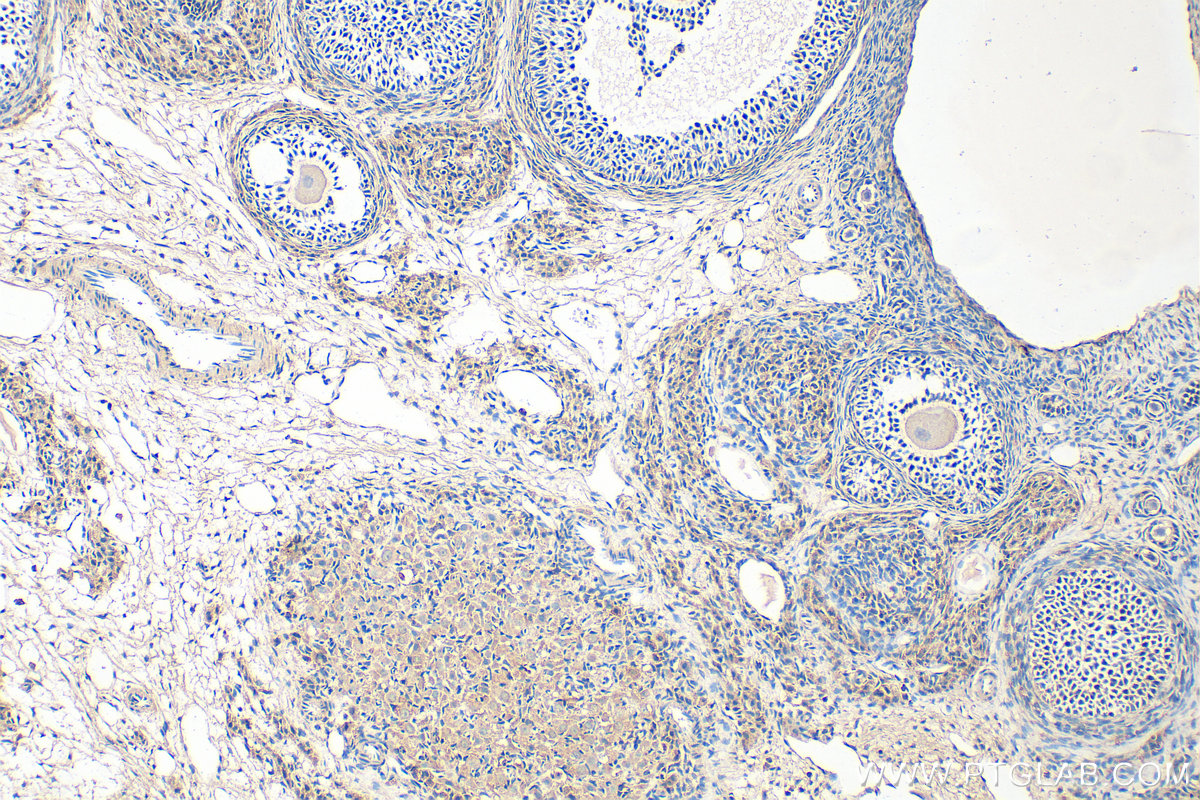 Immunohistochemistry (IHC) staining of rat ovary tissue using BMPR1B Polyclonal antibody (26696-1-AP)