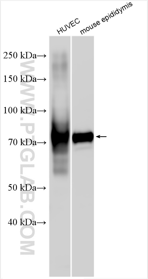 Western Blot (WB) analysis of various lysates using BMX Polyclonal antibody (27413-1-AP)