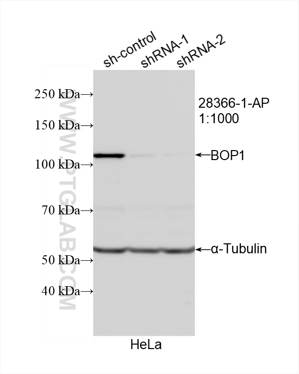 Western Blot (WB) analysis of HeLa cells using BOP1 Polyclonal antibody (28366-1-AP)