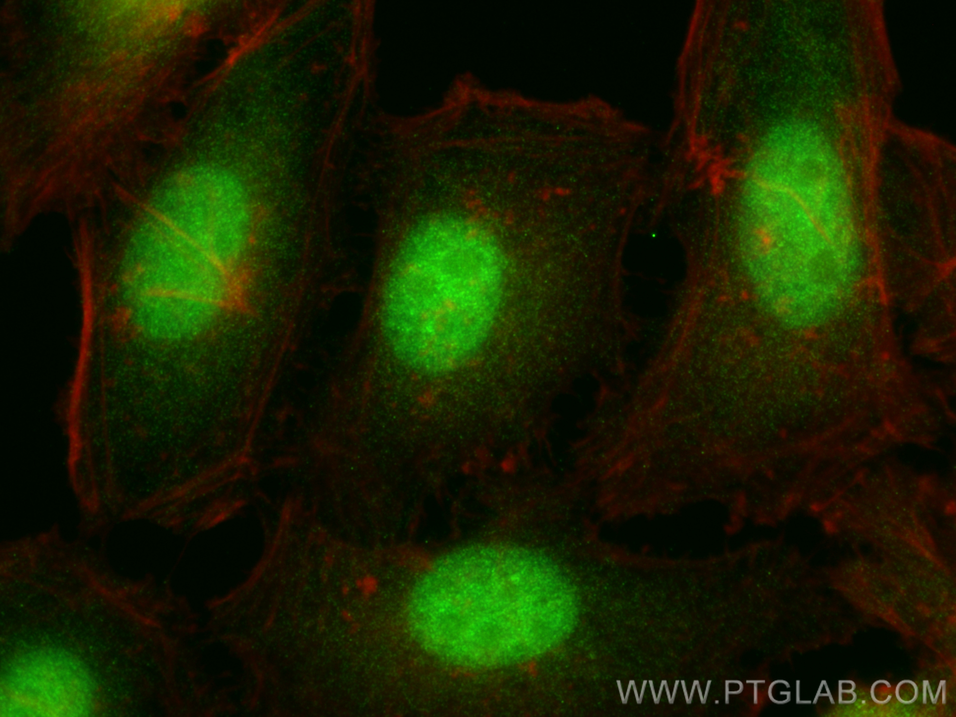 Immunofluorescence (IF) / fluorescent staining of HeLa cells using BORIS Polyclonal antibody (11074-2-AP)