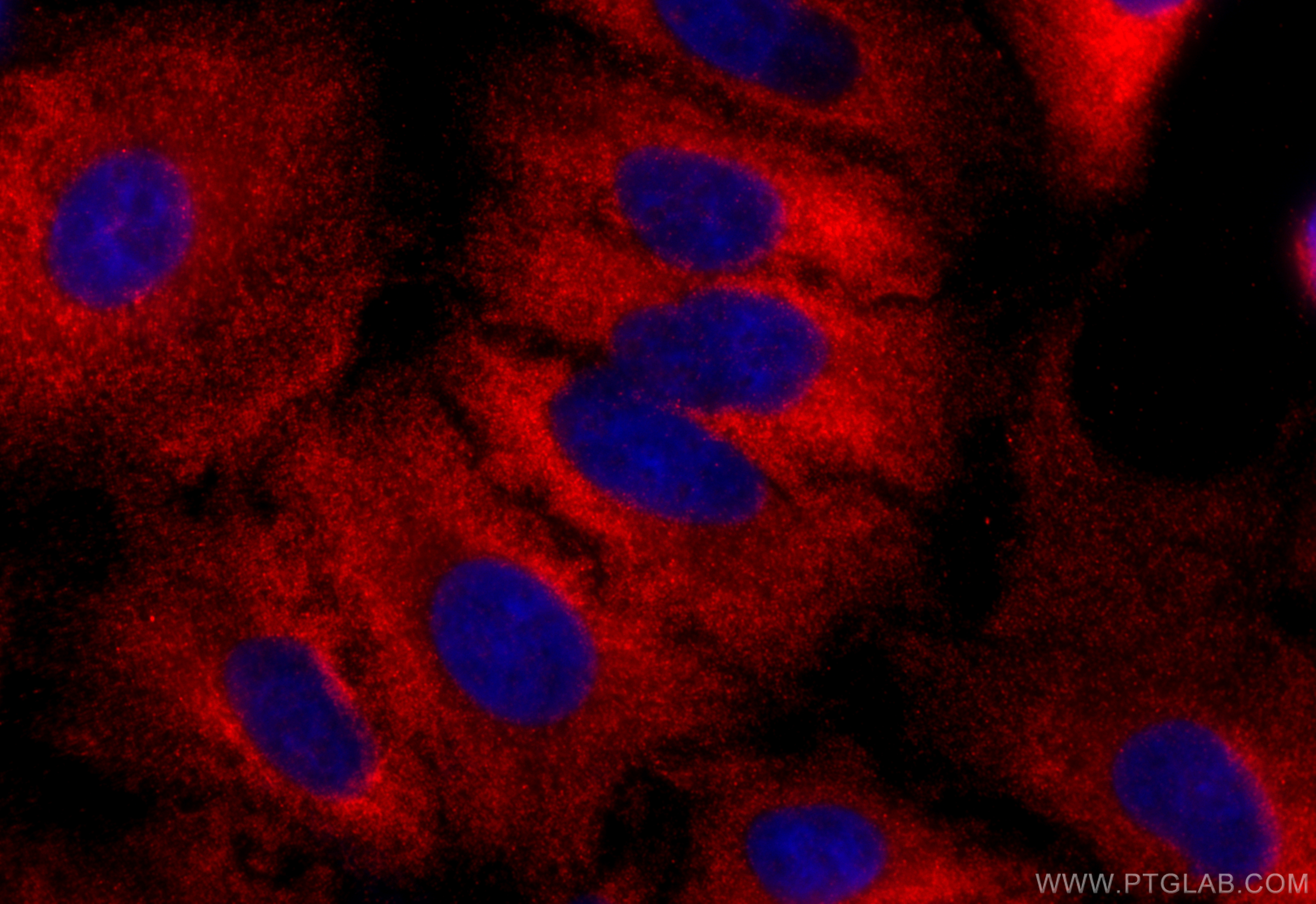 Immunofluorescence (IF) / fluorescent staining of A549 cells using BPIL1 Polyclonal antibody (13461-2-AP)