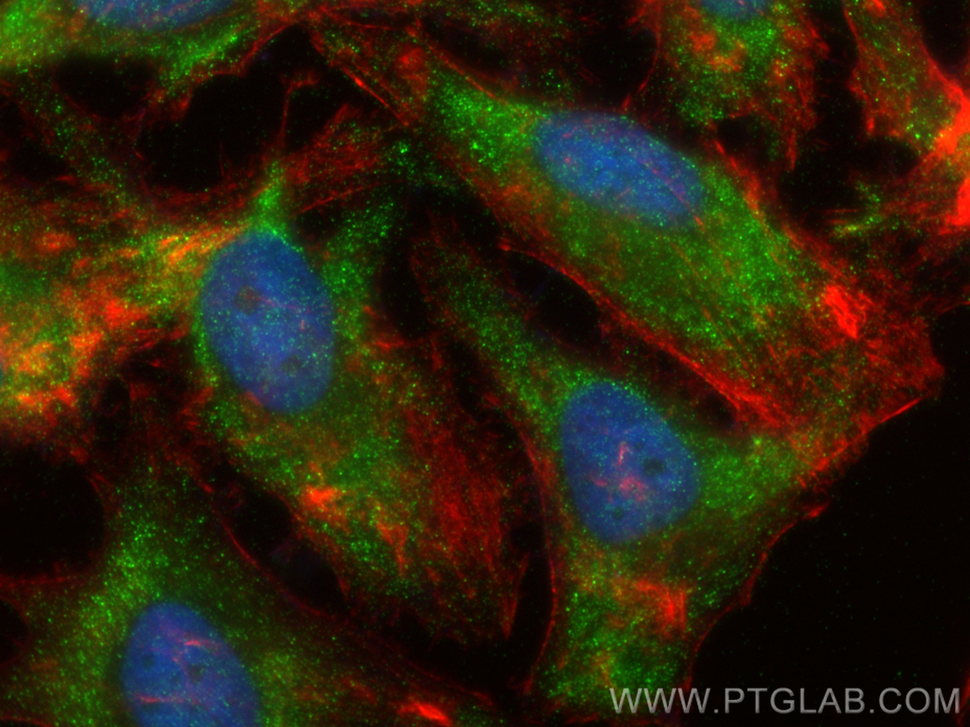 Immunofluorescence (IF) / fluorescent staining of HeLa cells using BRAP Recombinant antibody (83314-6-RR)