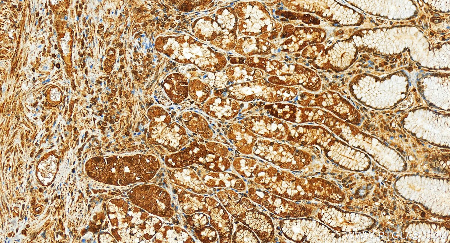 Immunohistochemistry (IHC) staining of human stomach tissue using BRD2 Polyclonal antibody (22236-1-AP)