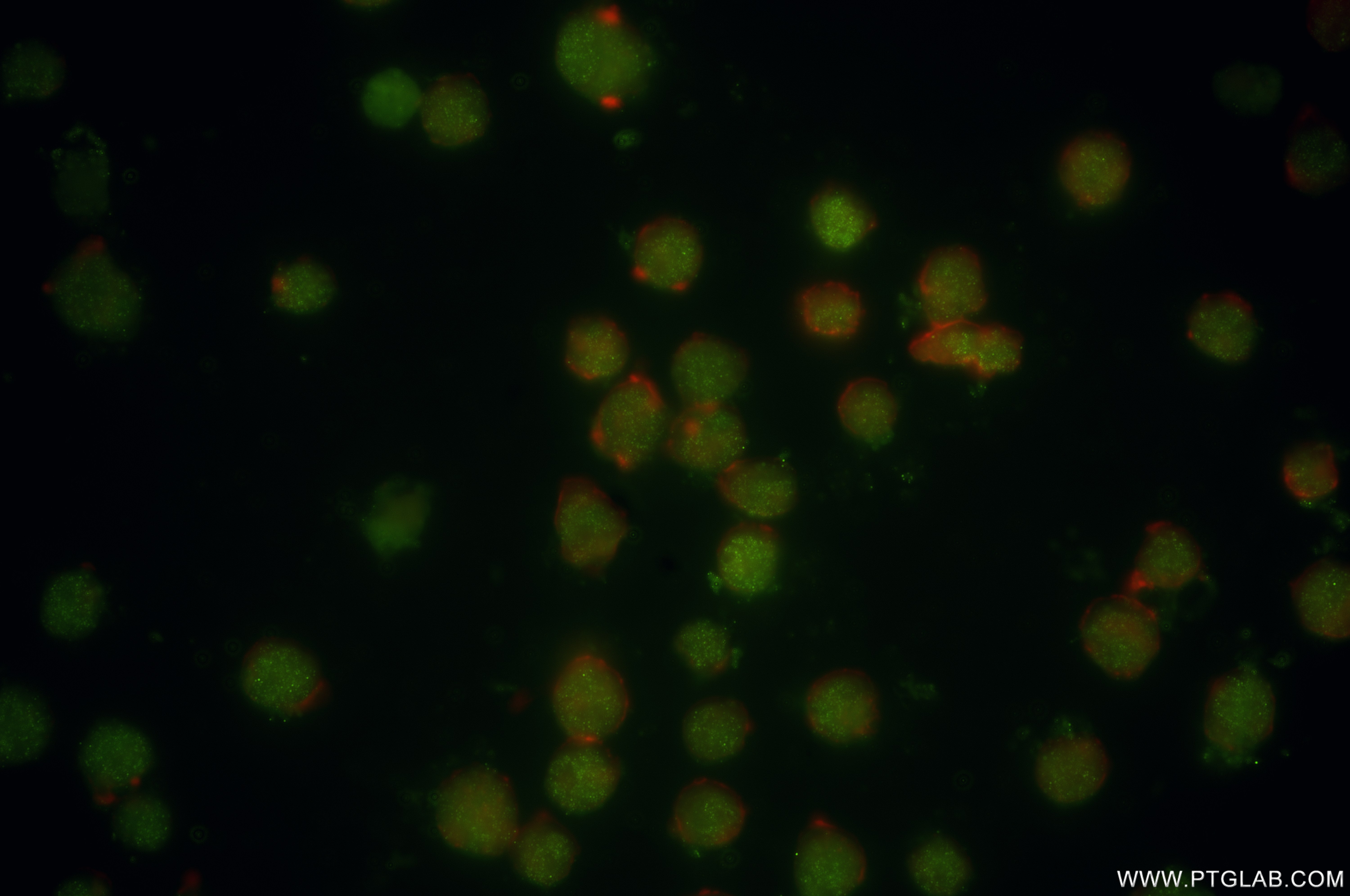 Immunofluorescence (IF) / fluorescent staining of Jurkat cells using BRD2 Recombinant antibody (85990-2-RR)