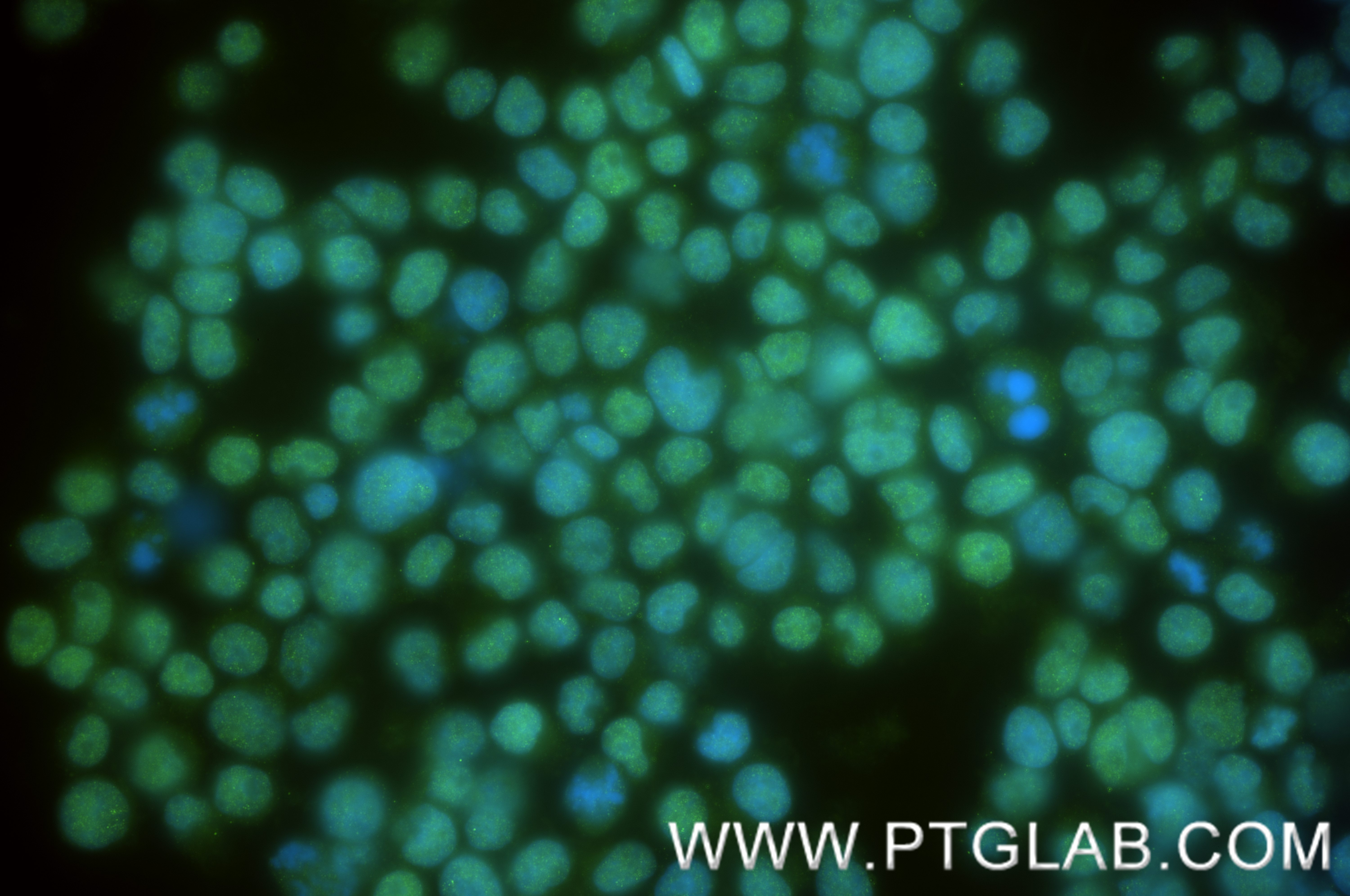 Immunofluorescence (IF) / fluorescent staining of Jurkat cells using BRD2 Recombinant antibody (85990-2-RR)