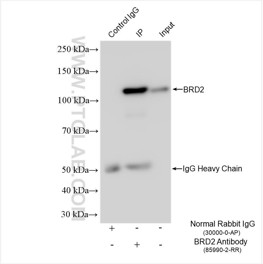 Immunoprecipitation (IP) experiment of HeLa cells using BRD2 Recombinant antibody (85990-2-RR)