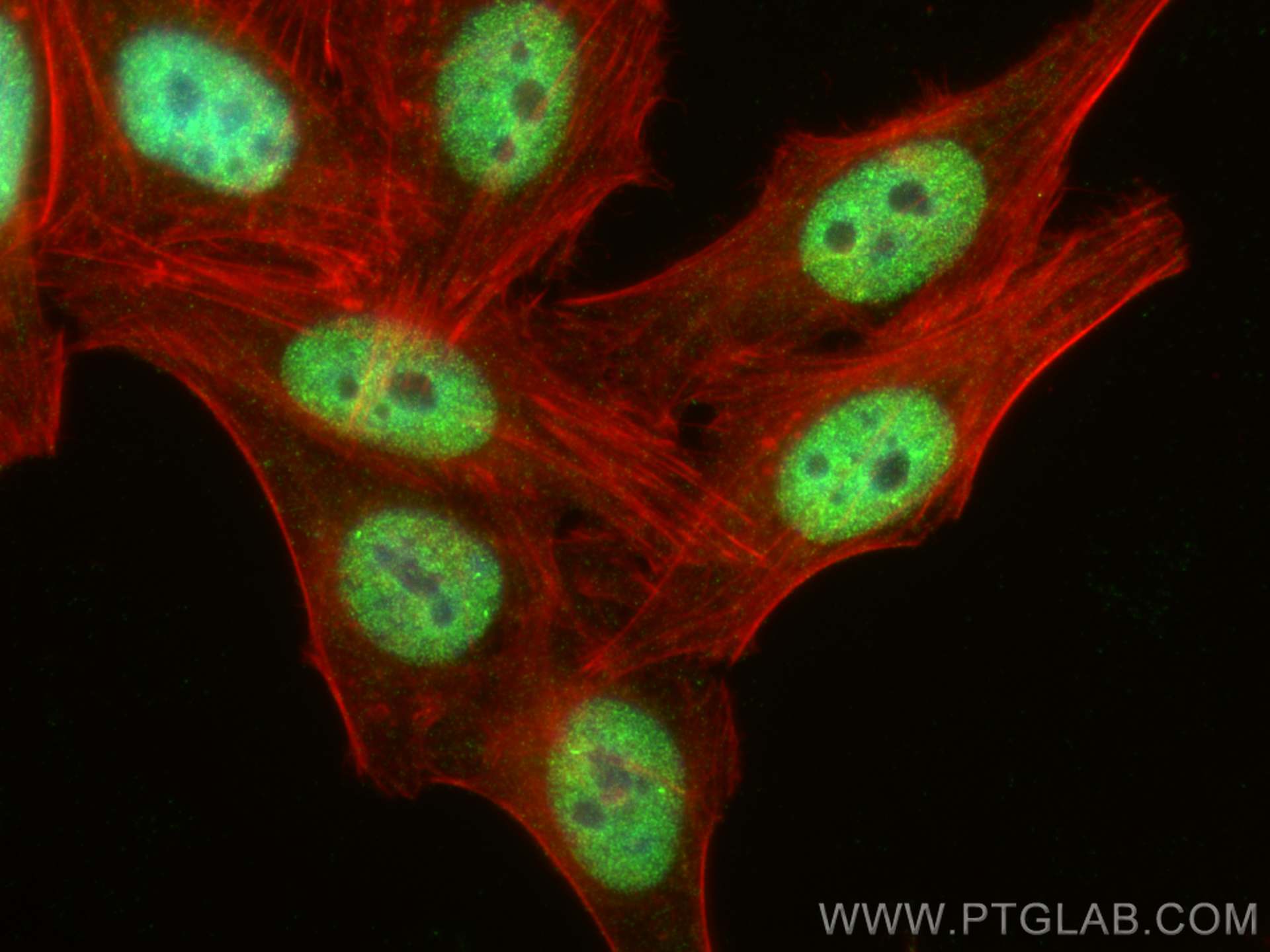 Immunofluorescence (IF) / fluorescent staining of HepG2 cells using BRD4 Polyclonal antibody (28486-1-AP)