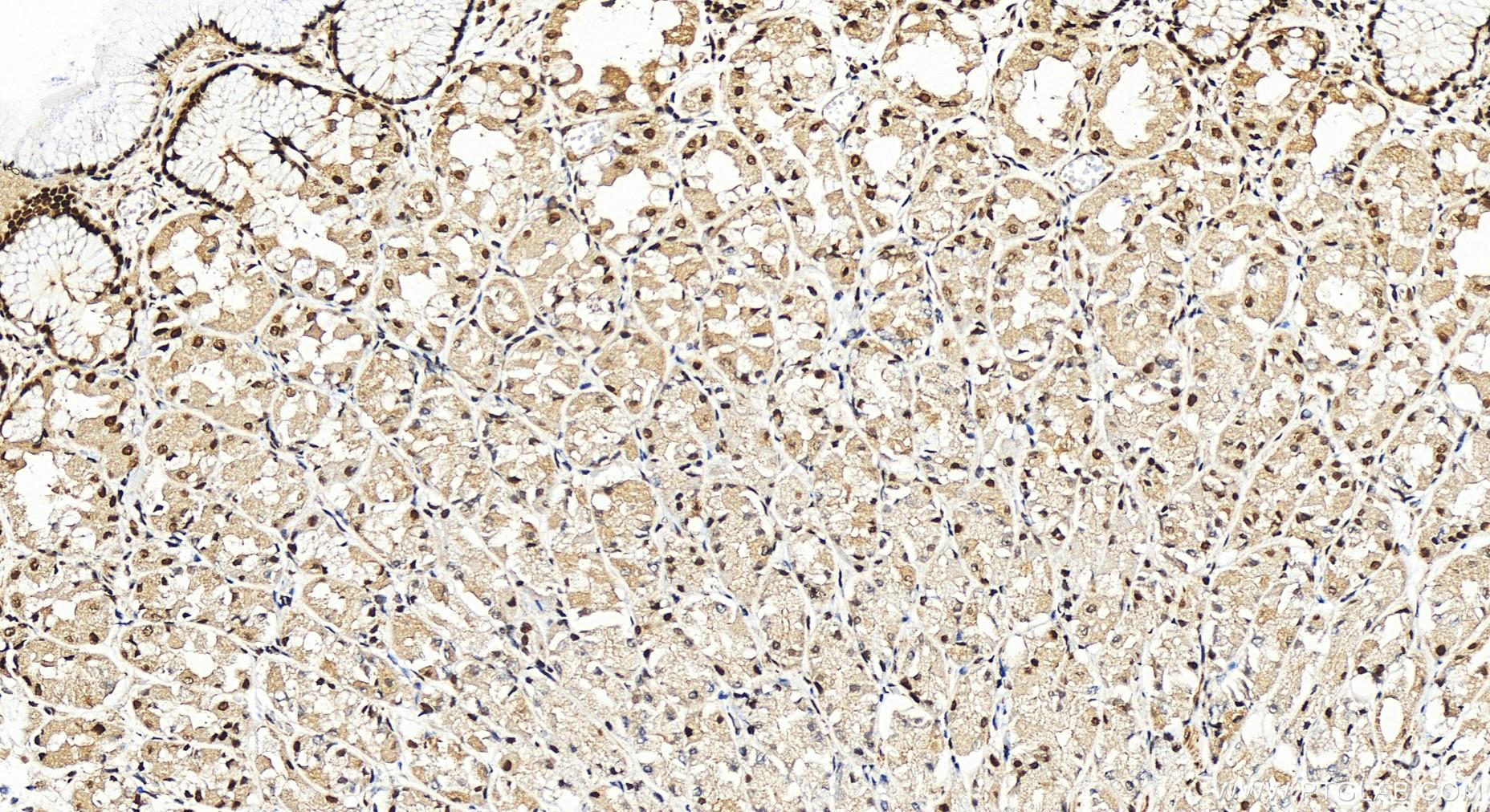 Immunohistochemistry (IHC) staining of human stomach tissue using BRD8 Polyclonal antibody (10476-1-AP)