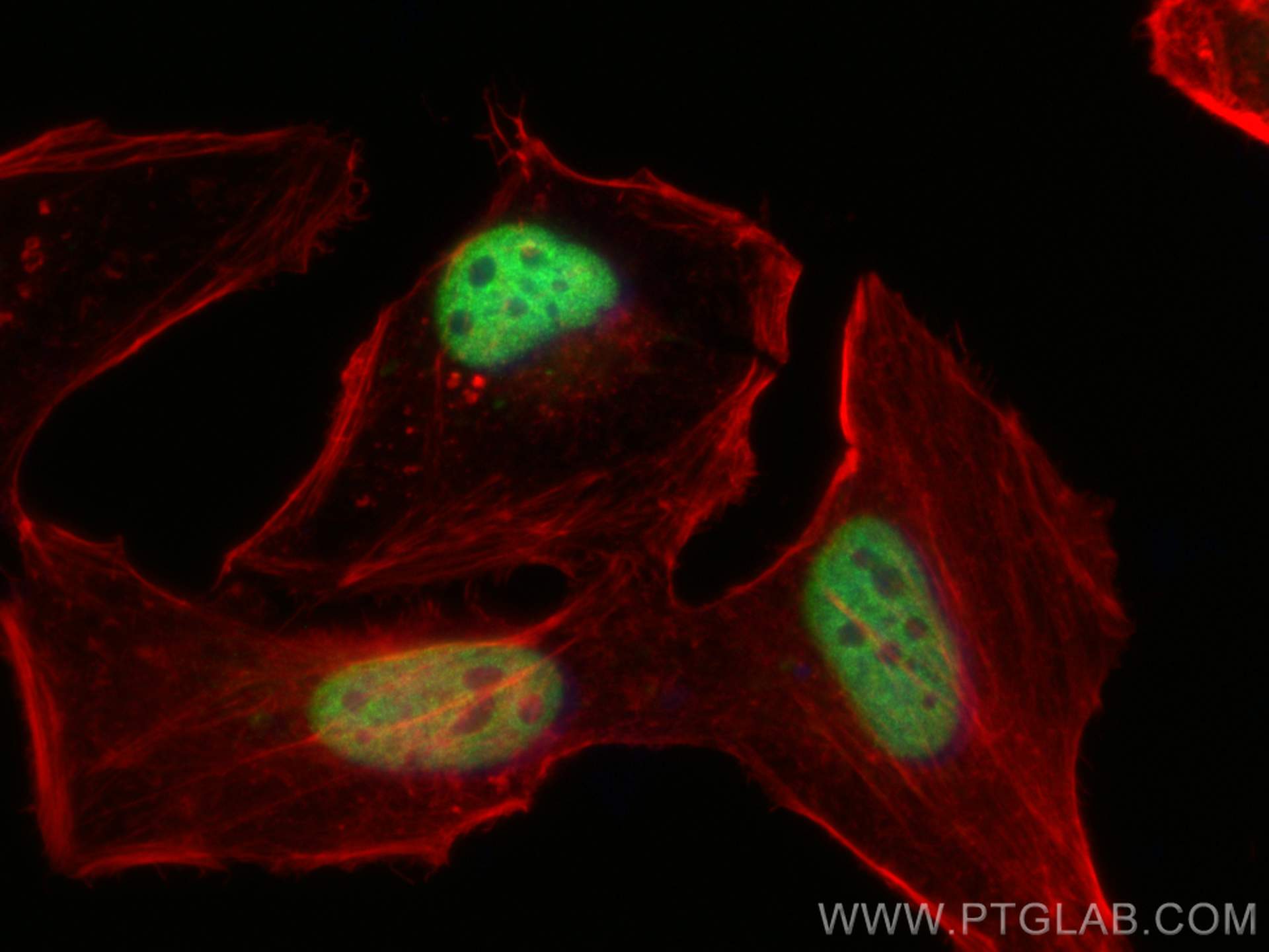 Immunofluorescence (IF) / fluorescent staining of HeLa cells using BRD8 Polyclonal antibody (10476-1-AP)