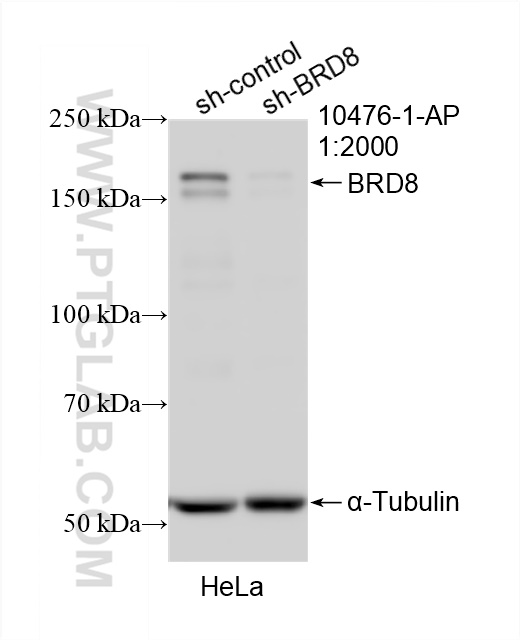 Western Blot (WB) analysis of HeLa cells using BRD8 Polyclonal antibody (10476-1-AP)