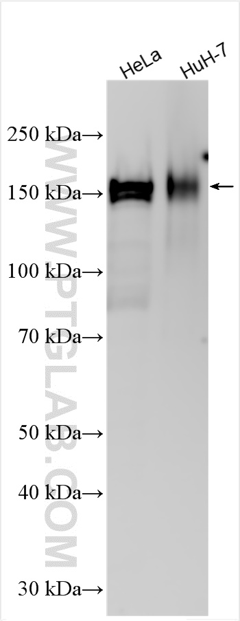 Western Blot (WB) analysis of various lysates using BRD8 Polyclonal antibody (10476-1-AP)