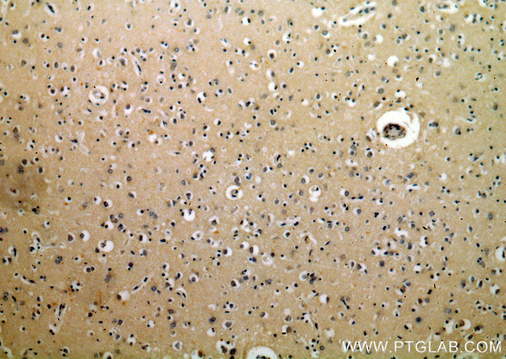 Immunohistochemistry (IHC) staining of human brain tissue using BRI3 Polyclonal antibody (14591-1-AP)