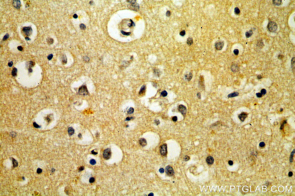 Immunohistochemistry (IHC) staining of human brain tissue using BRI3 Polyclonal antibody (14591-1-AP)