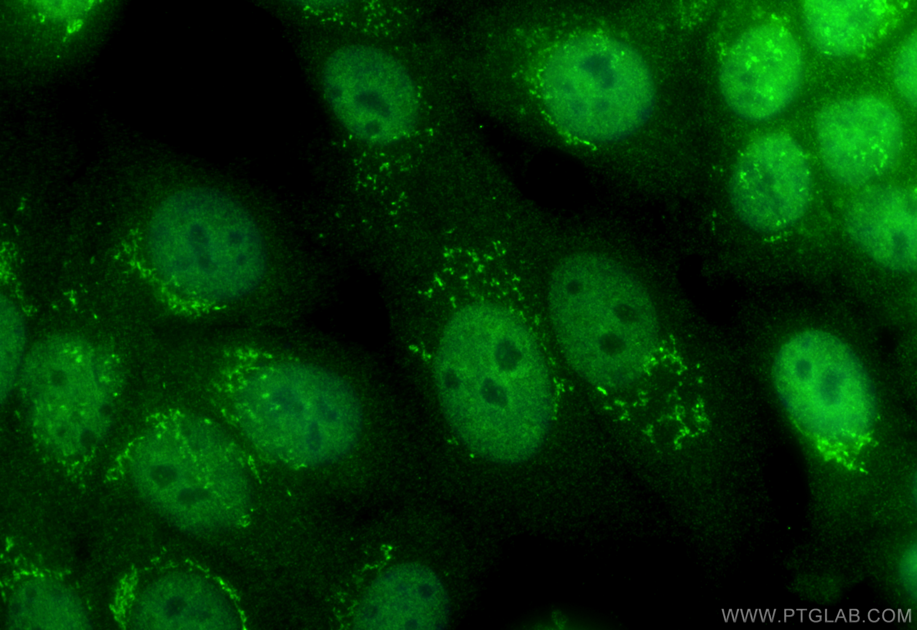 Immunofluorescence (IF) / fluorescent staining of MCF-7 cells using BRMS1 Polyclonal antibody (16096-1-AP)